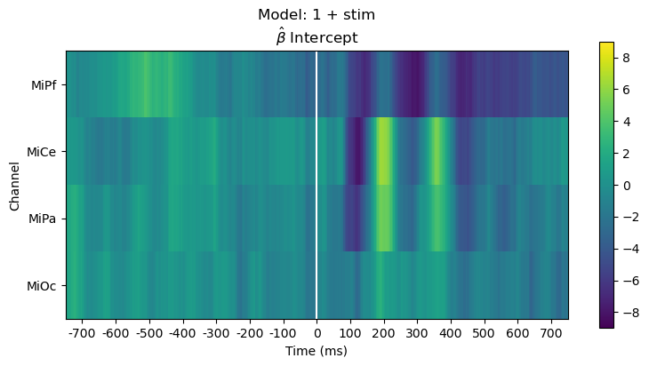 Model: 1 + stim $\hat{\beta}$ Intercept