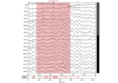 Quickstart: mkh5 to MNE