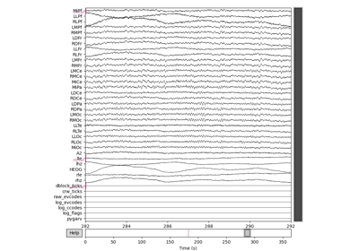 EEG without events or epochs